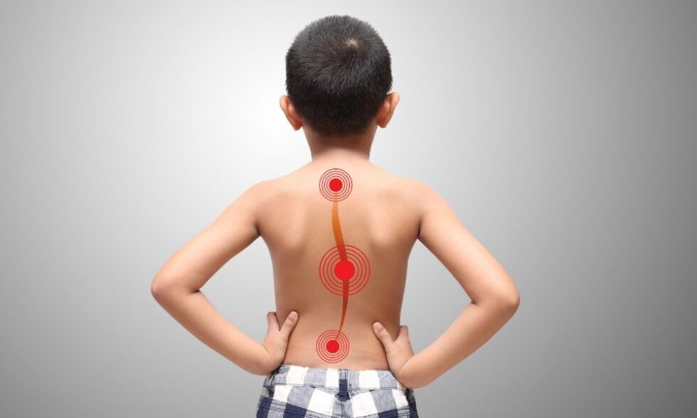 What Does Bracing for Scoliosis Look Like?