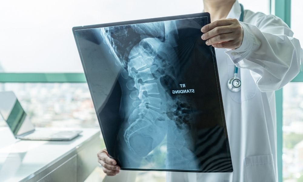 What Are the Different Kinds of Scoliosis Spine Surgery?