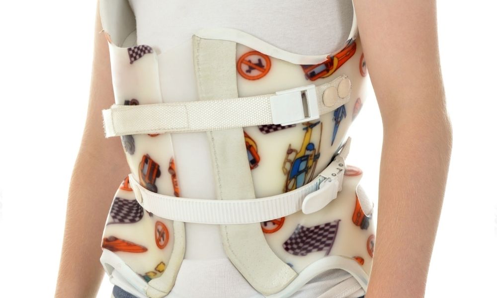 What Are the Different Types of Scoliosis Braces?